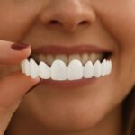 Aufsteckbare Verblendungen