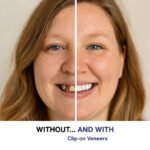 Aufsteckbare Verblendungen – Image 3