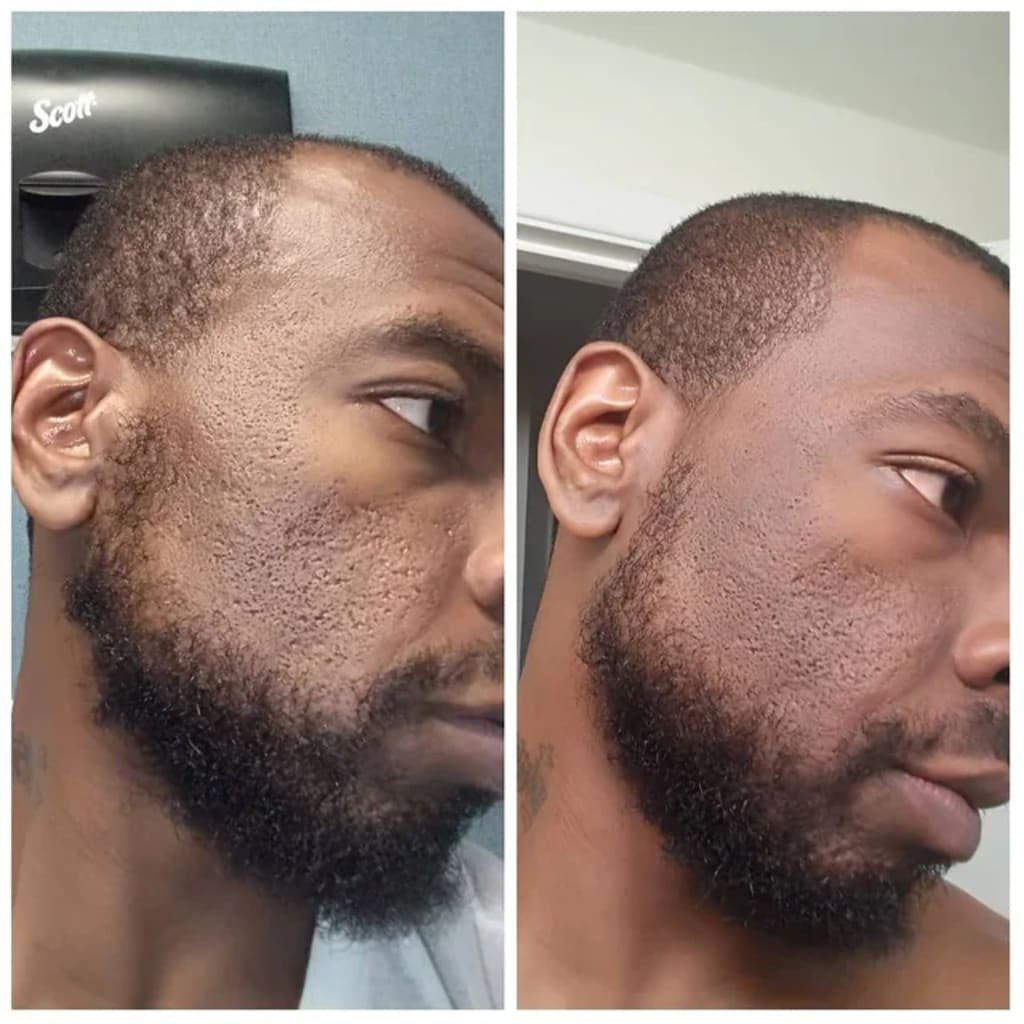 Glas-Haut Premium-Kit (6 Stück) – Image 6